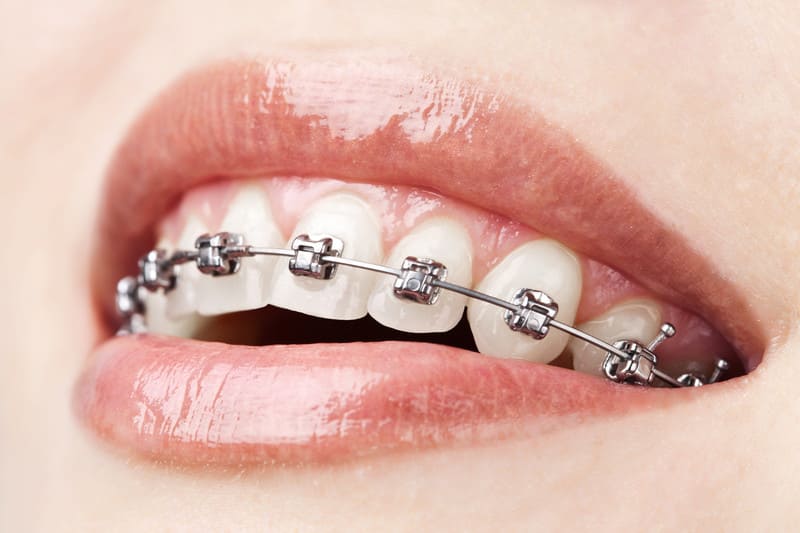 DOCS Dental orthodontics